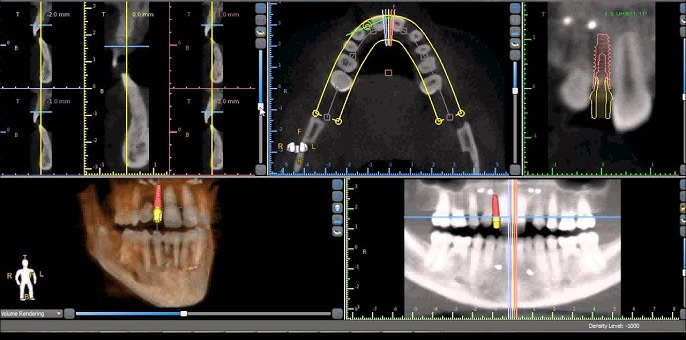 cbct-image