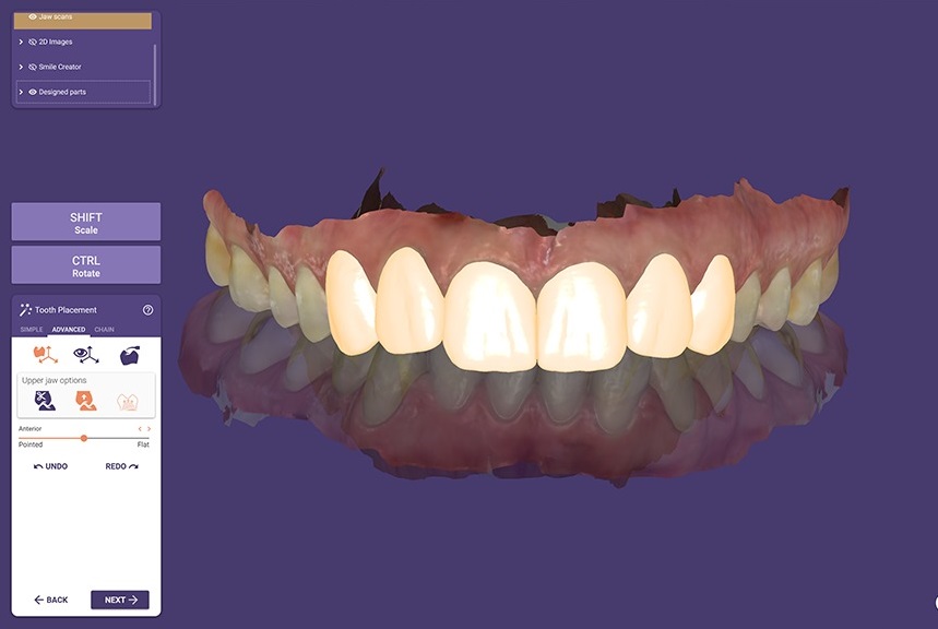 gulus-tasarimi-elaynerlab-5